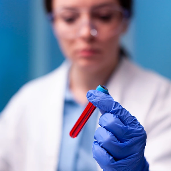 Hematologija Poliklinika Neuromedic Nis